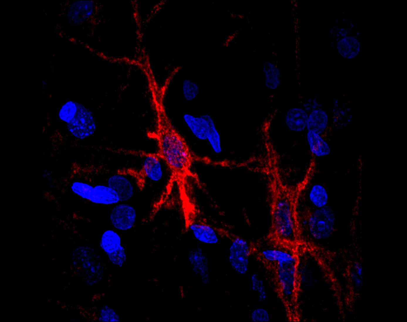 Confocal microscopy of mouse cortex: perineuronal nets in red wrapped around neuron cell bodies, with cell nuclei stained blue